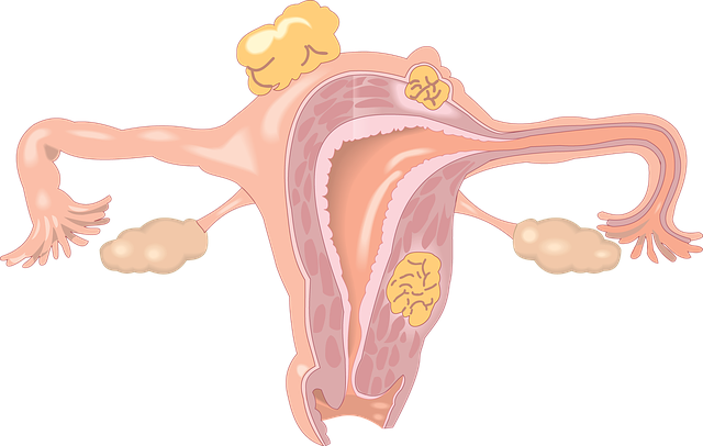 menstrual